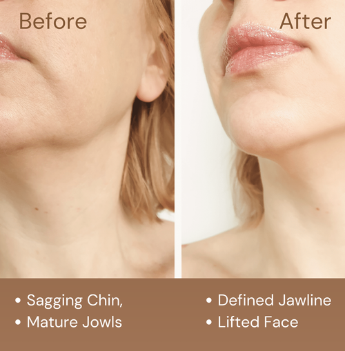 Lymphatic Facial Contour Brush